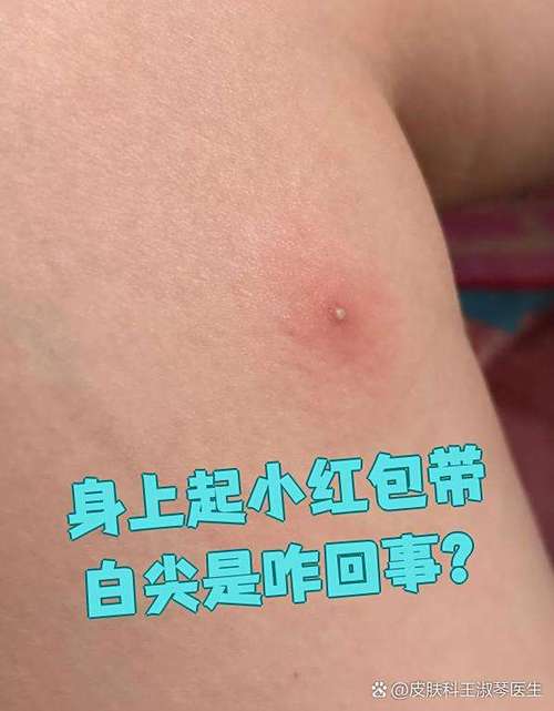 身上时不时长小红包