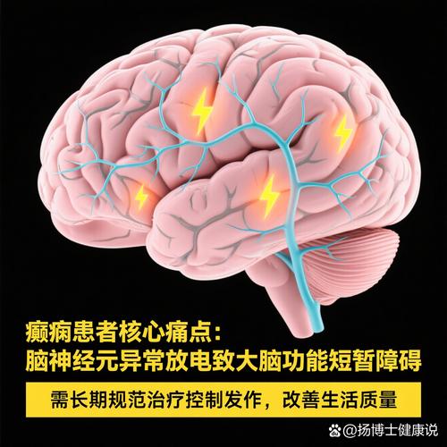 大脑异常放电但不抽搐