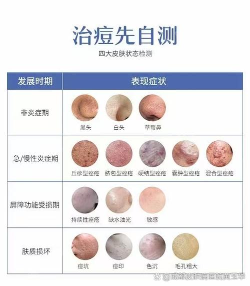 皮肤病拍照自测app