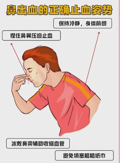 打喷嚏打出鼻血