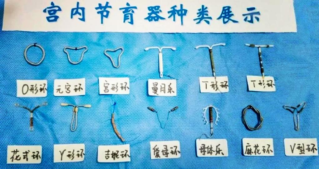 最新节育环的种类名称
