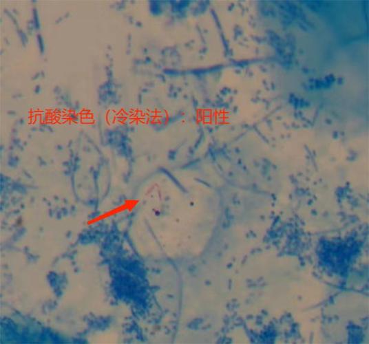 x染色阳性