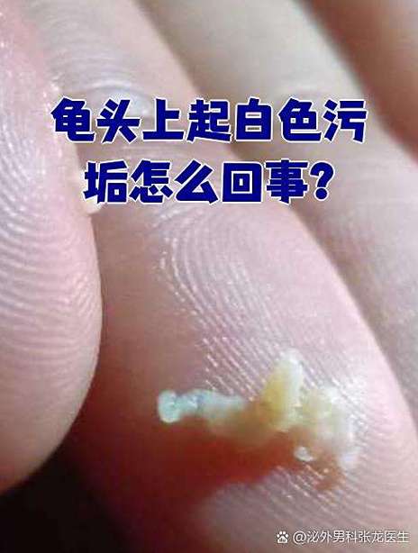 男人龟的头部有白色污垢是什么原因