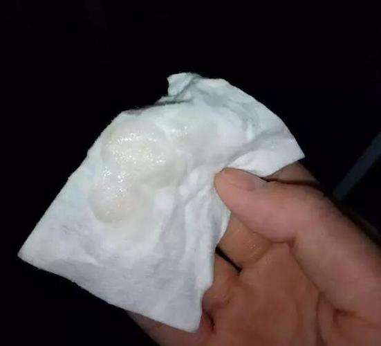 同房后出现白色浆糊分泌物正常吗