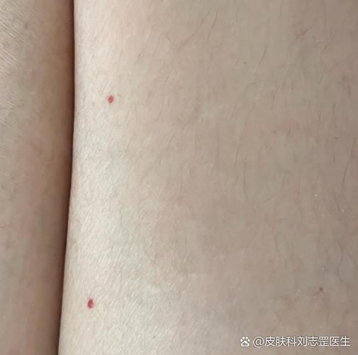身上红点不痛不痒图片游戏截图
