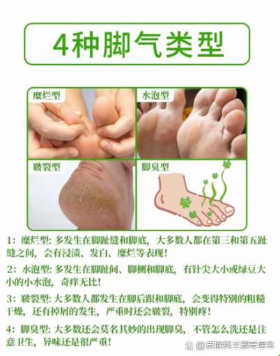 脚足癣图片