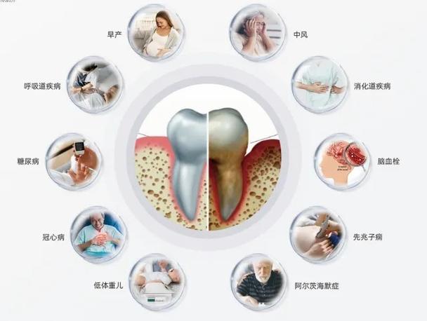 测幽门螺旋杆菌能刷牙吗缩略图