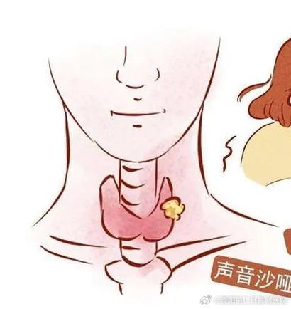 说话声音正常唱歌嘶哑