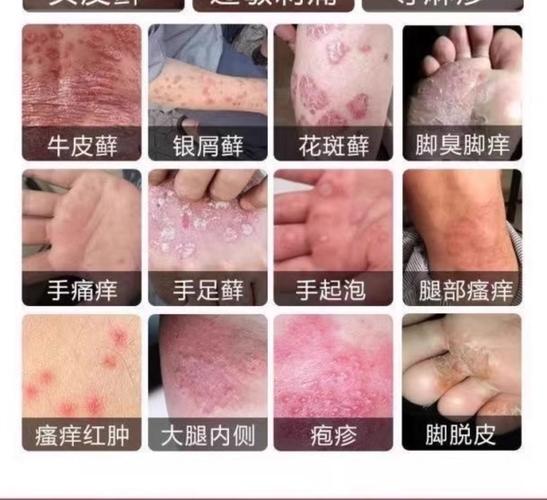 方块人被敌人挠痒痒的解决方法