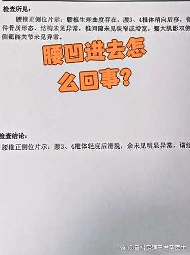 女性腰后正中凹陷深