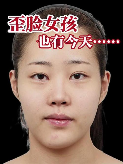 正常看脸不歪拍照脸歪