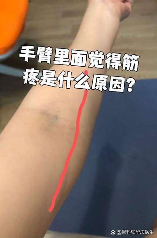 扭脖子一根筋连着肩胛骨疼