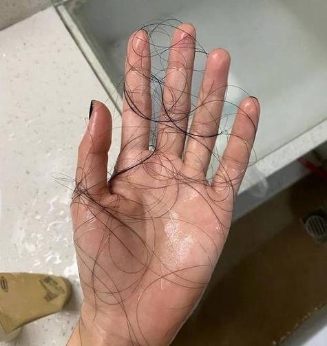 怎么把头发p掉