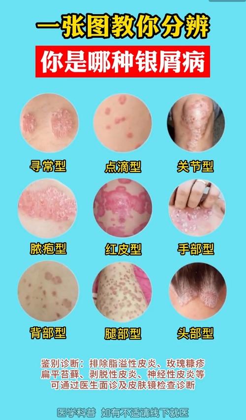 扫一扫识别皮肤病拍照