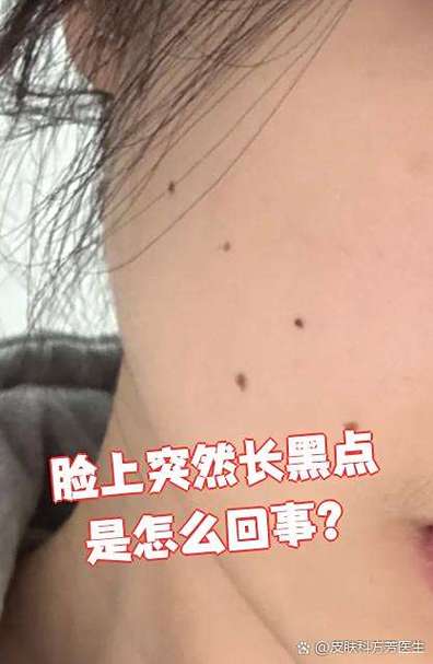 活的面隔夜会有小黑点
