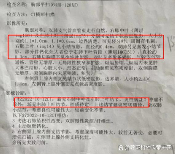 肺结节8mm严重吗?需要治疗吗