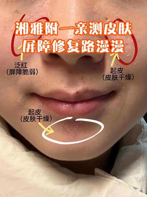 女友突然屏蔽你的含义