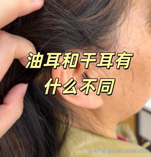 油耳和干耳哪个更聪明