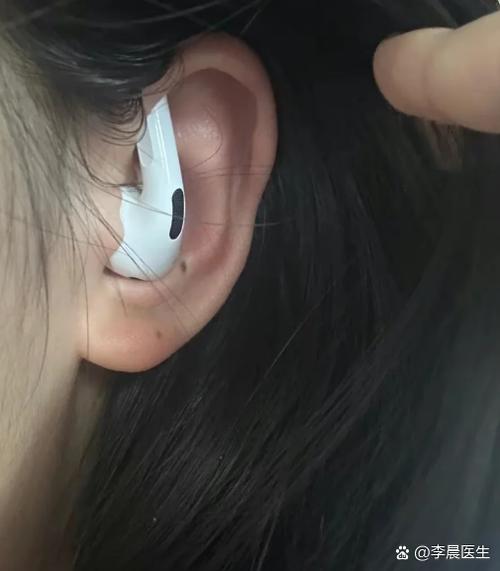 戴入耳式耳机耳朵痒截图