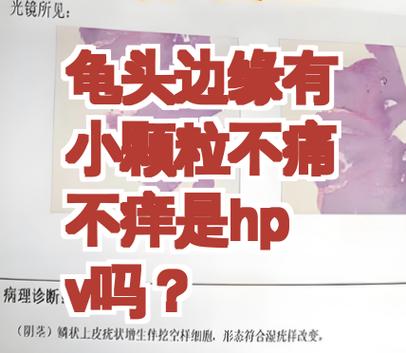 茎体上长红色点点不痛不痒缩略图