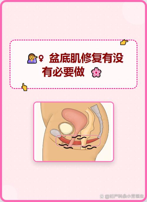 盆底肌修复和子宫修复有啥区别
