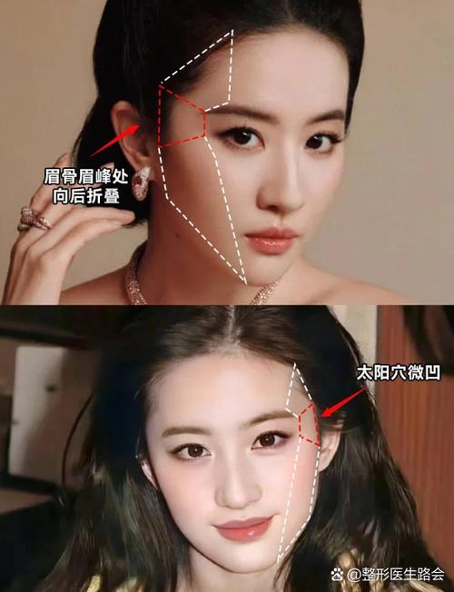 女人太阳凹陷怎么改善游戏截图