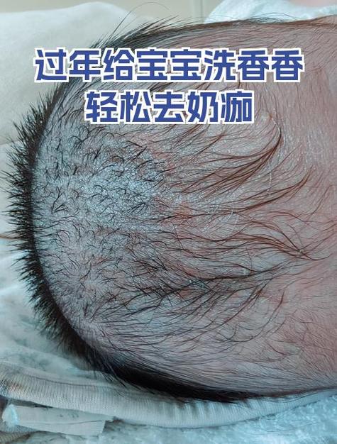 宝宝为什么擦香香脸变黑了?图标