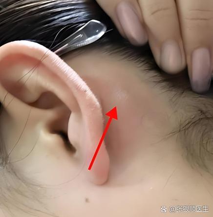 名字后面有个耳朵截图