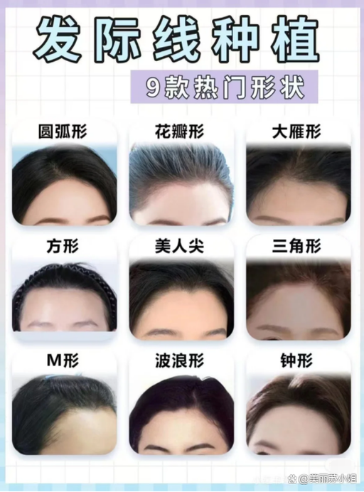 成都植发医院排名前十