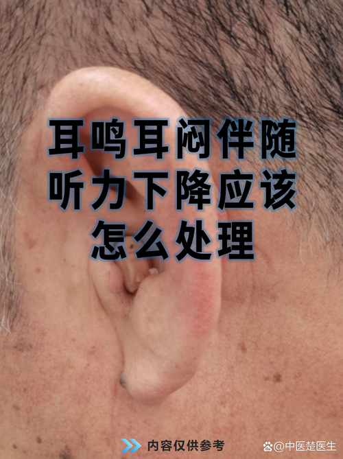 耳机一晃动就暂停