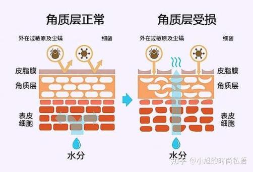 角质层薄的原因