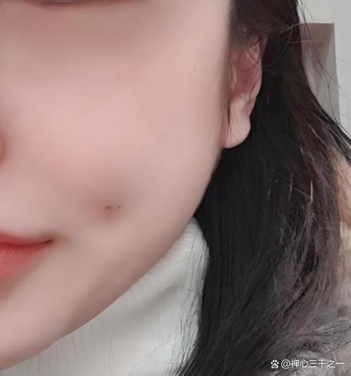 酒窝有几种类型