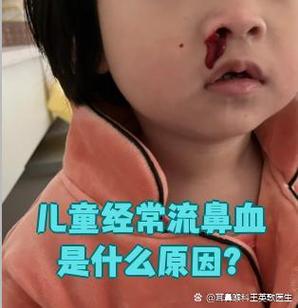 小学生爱流鼻血