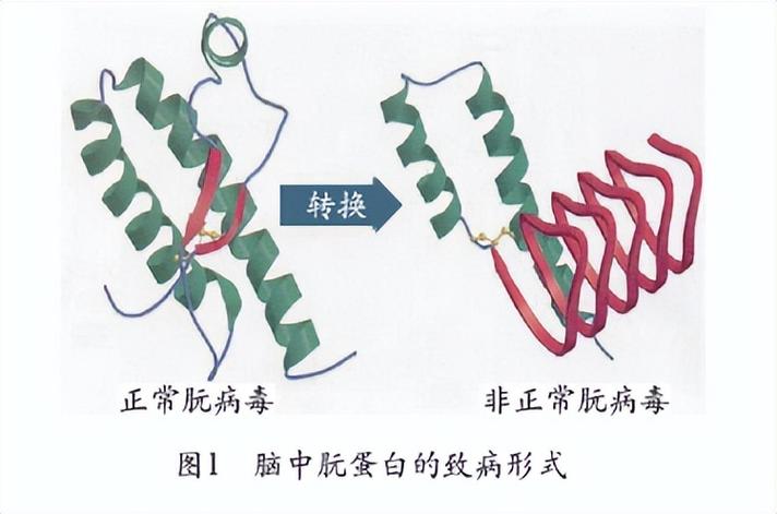 朊病毒