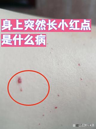 来信息怎样有小红点