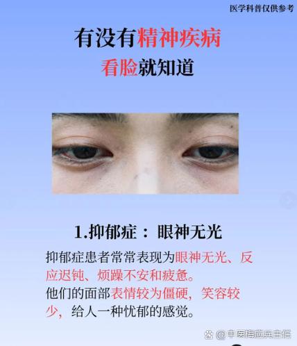 焦虑症是5羟色胺多还是少了