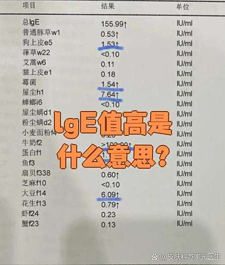 总抗体ige高是什么意思截图