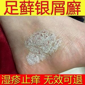 专治脚裂的药膏