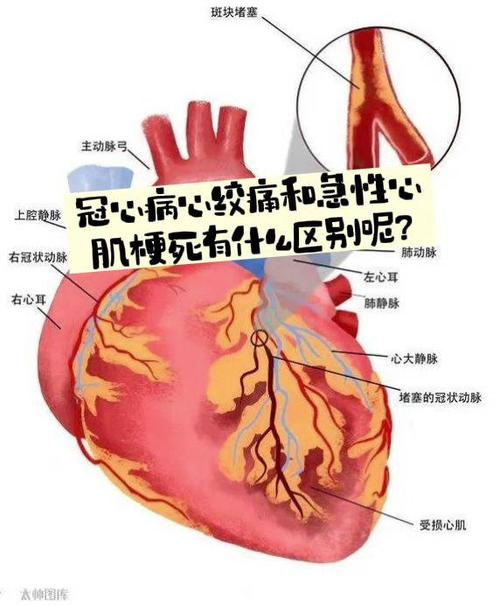 lgt医学上代表什么