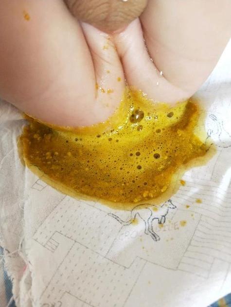 播放粑粑屎的照片