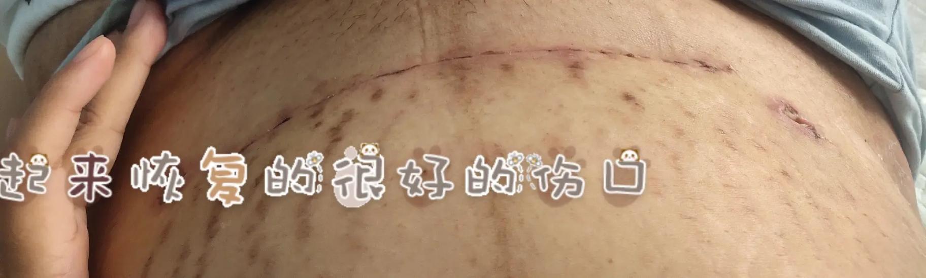 肚子疼纪实贴吧缩略图