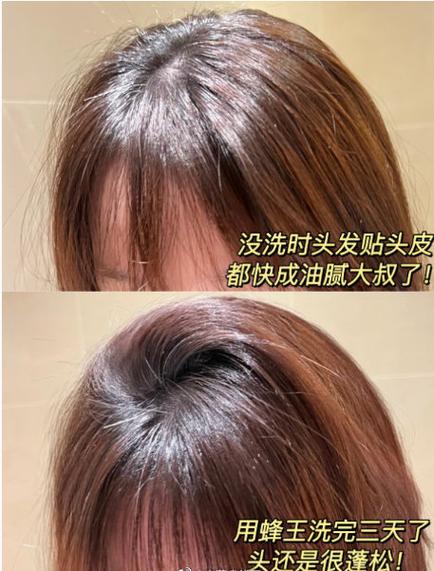 头发保湿第一名缩略图