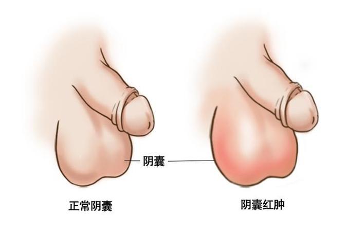 男人只有一个睾丸正常吗