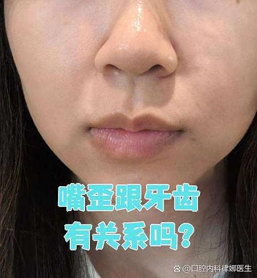 掉了牙齿对嘴歪有关系吗