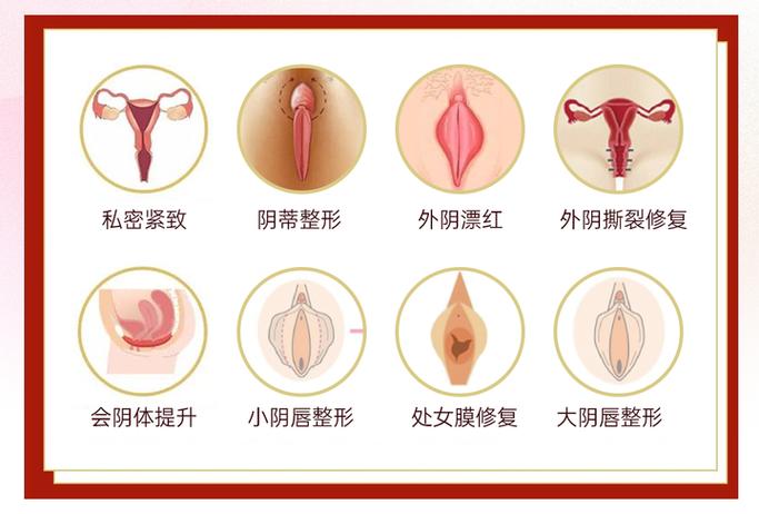 阴壁下垂可以恢复吗截图