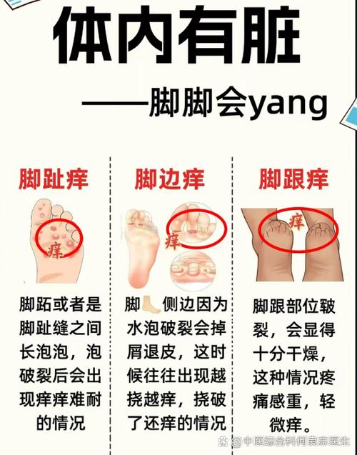 挠脚底板为什么会痒缩略图