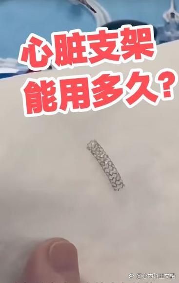 心脏支架4个还能活多久