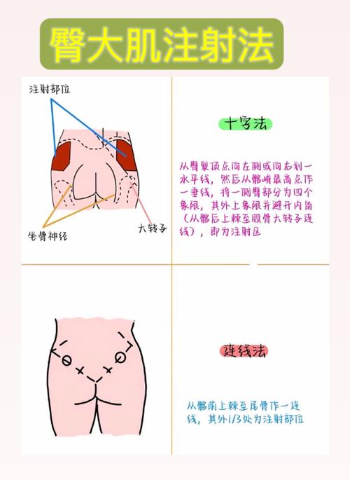打屁股针疼怎么缓解
