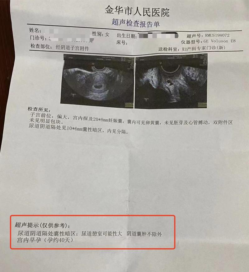 b超单子pi是什么意思