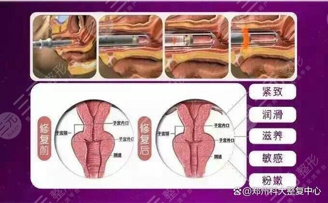 女人做紧缩手术有什么坏处